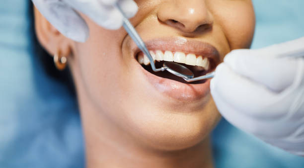 Best Emergency Dentist for Special Needs Patients in Tuskegee, AL