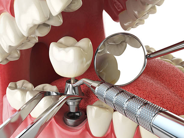 Best Weekend Emergency Dentist in Tuskegee, AL